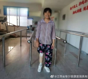 上饒九江假肢