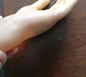 南昌江西假肢